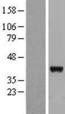 Western Blot: LRRC46 Overexpression Lysate [NBL1-12696]