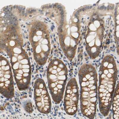 Immunohistochemistry-Paraffin: LRRC47 Antibody [NBP1-93597]