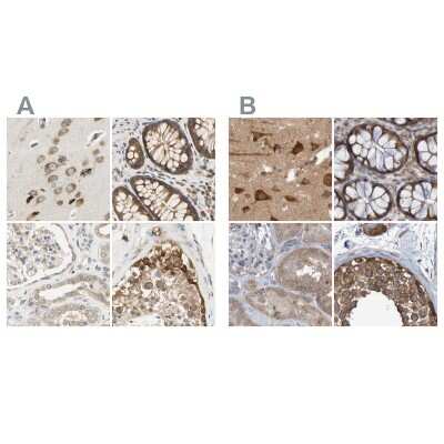 Immunohistochemistry-Paraffin: LRRC47 Antibody [NBP1-93597]