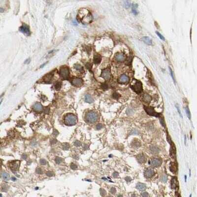 Immunohistochemistry-Paraffin: LRRC47 Antibody [NBP1-93597]