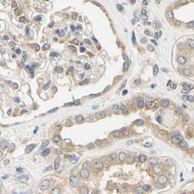 Immunohistochemistry-Paraffin: LRRC47 Antibody [NBP1-93597]