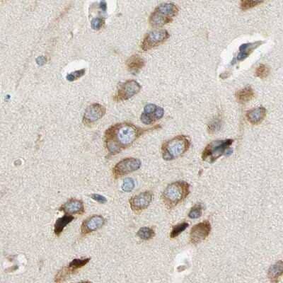 Immunohistochemistry-Paraffin: LRRC47 Antibody [NBP1-93597]