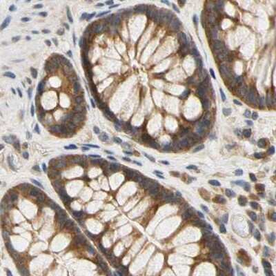 Immunohistochemistry-Paraffin: LRRC47 Antibody [NBP1-93597]