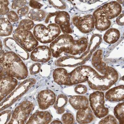 Immunohistochemistry-Paraffin: LRRC47 Antibody [NBP1-93598]