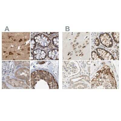 Immunohistochemistry-Paraffin: LRRC47 Antibody [NBP1-93598]