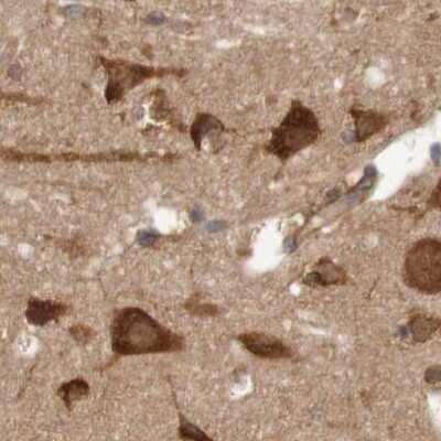 Immunohistochemistry-Paraffin: LRRC47 Antibody [NBP1-93598]