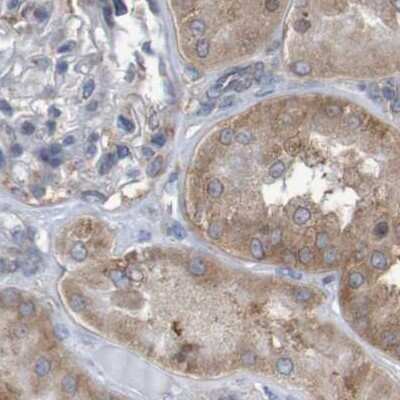 Immunohistochemistry-Paraffin: LRRC47 Antibody [NBP1-93598]