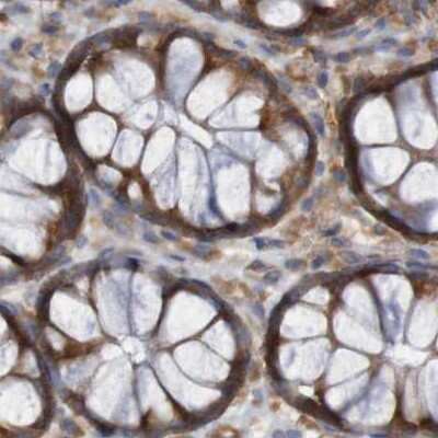Immunohistochemistry-Paraffin: LRRC47 Antibody [NBP1-93598]
