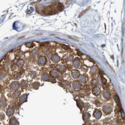 Immunohistochemistry-Paraffin: LRRC47 Antibody [NBP1-93598]