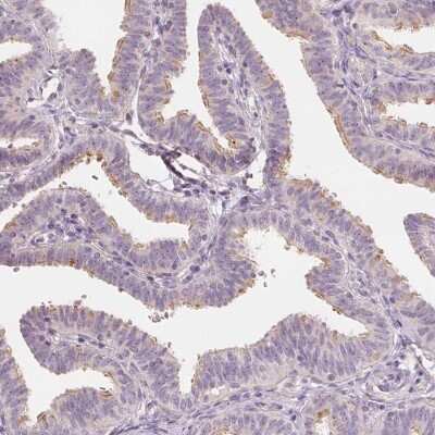 Immunohistochemistry: LRRC48 Antibody [NBP2-38277]