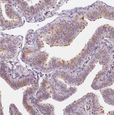 Immunohistochemistry-Paraffin: LRRC48 Antibody [NBP1-84128]