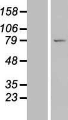 Western Blot: LRRC49 Overexpression Lysate [NBL1-12698]