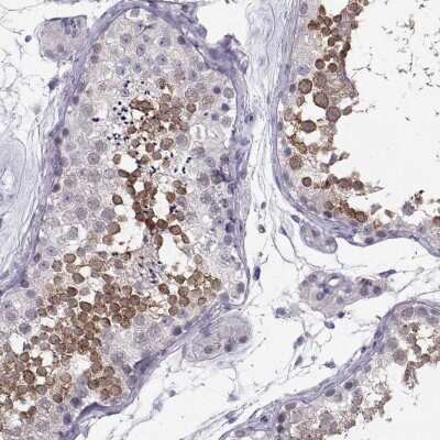 Immunohistochemistry-Paraffin: LRRC50 Antibody [NBP2-62685]