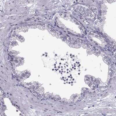 Immunohistochemistry-Paraffin: LRRC50 Antibody [NBP2-62685]