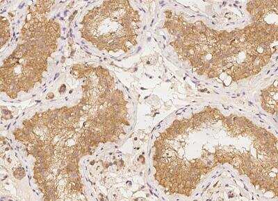 Immunohistochemistry-Paraffin: LRRC50 Antibody [NBP3-05790]