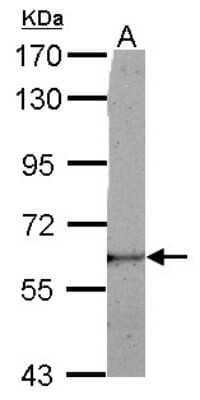 Western Blot: LRRC50 Antibody [NBP2-17171]