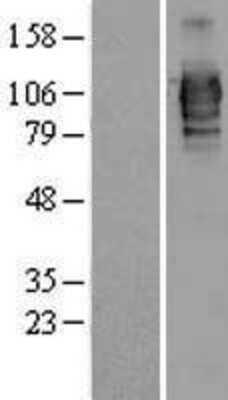 Western Blot: LRRC50 Overexpression Lysate [NBL1-12700]