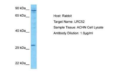 Western Blot: LRRC52 Antibody [NBP2-84148]