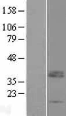 Western Blot: LRRC52 Overexpression Lysate [NBP2-08880]