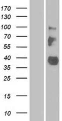 Western Blot: LRRC55 Overexpression Lysate [NBP2-08878]