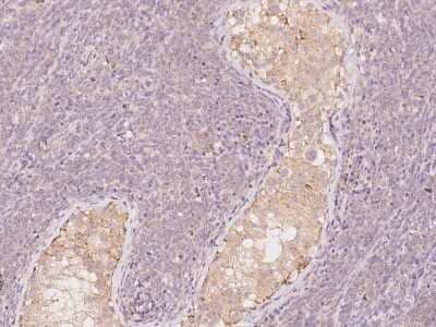 Immunohistochemistry-Paraffin: LRRC56 Antibody [NBP2-98195]