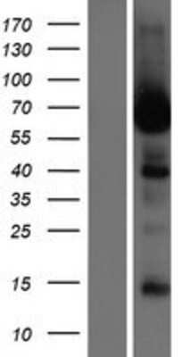 Western Blot: LRRC56 Overexpression Lysate [NBP2-04744]