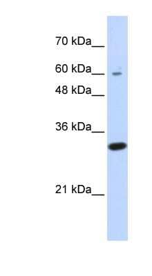 Western Blot: LRRC57 Antibody [NBP1-56321]