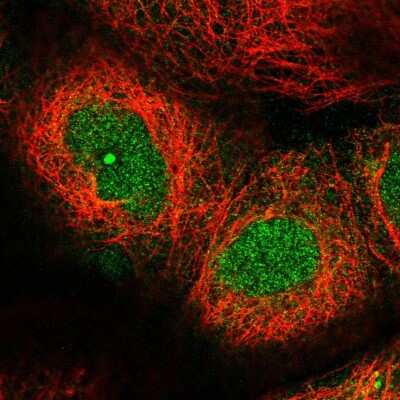 Immunocytochemistry/ Immunofluorescence: LRRC58 Antibody [NBP2-34153]