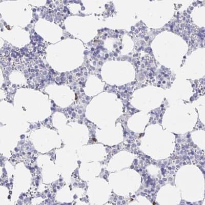 Immunohistochemistry-Paraffin: LRRC58 Antibody [NBP2-34153]