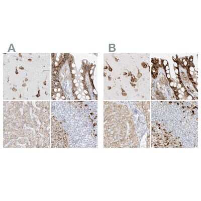 Immunohistochemistry-Paraffin: LRRC59 Antibody [NBP1-93952]