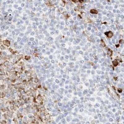 Immunohistochemistry-Paraffin: LRRC59 Antibody [NBP1-93952]