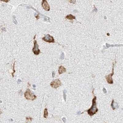 Immunohistochemistry-Paraffin: LRRC59 Antibody [NBP1-93952]