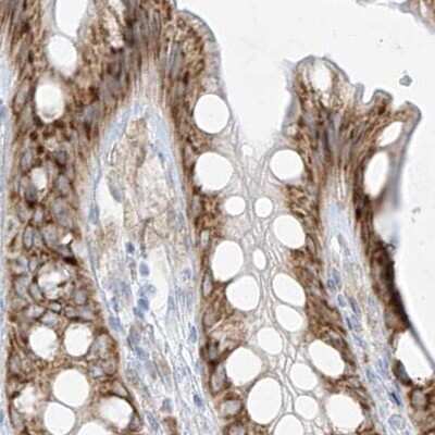 Immunohistochemistry-Paraffin: LRRC59 Antibody [NBP1-93952]