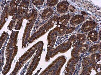 Immunohistochemistry-Paraffin: LRRC59 Antibody [NBP2-17172]