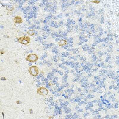 Immunohistochemistry-Paraffin: LRRC59 Antibody - BSA Free [NBP3-04577]