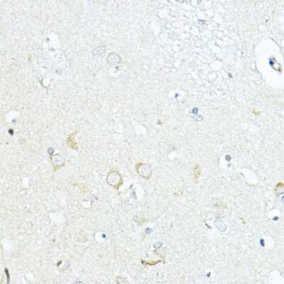 Immunohistochemistry-Paraffin: LRRC59 Antibody - BSA Free [NBP3-04577]