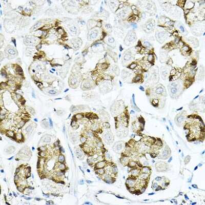 Immunohistochemistry-Paraffin: LRRC59 Antibody - BSA Free [NBP3-04577]