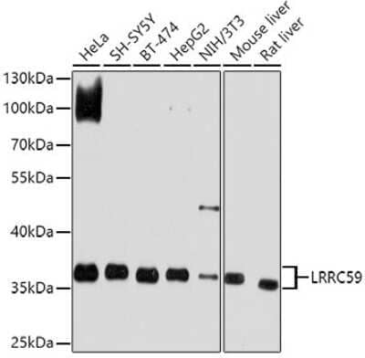 Western Blot: LRRC59 AntibodyBSA Free [NBP3-04577]