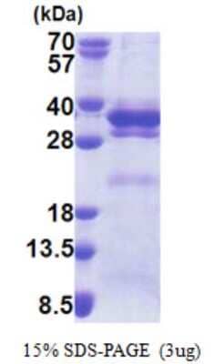 SDS-PAGE: Recombinant Human LRRC59 His Protein [NBP2-23191]