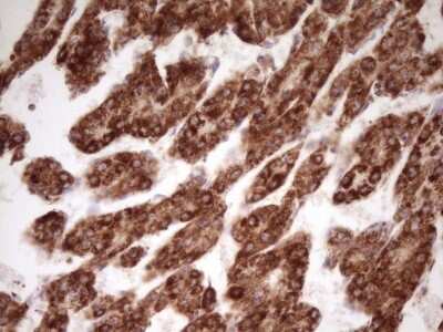 Immunohistochemistry: LRRC6 Antibody (OTI7E9) [NBP2-45674]