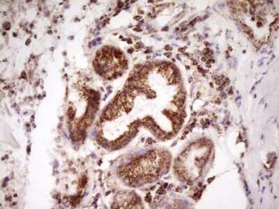 Immunohistochemistry: LRRC6 Antibody (OTI7E9) [NBP2-45674]