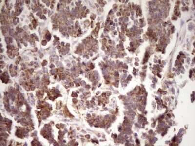 Immunohistochemistry: LRRC6 Antibody (OTI7E9) [NBP2-45674]
