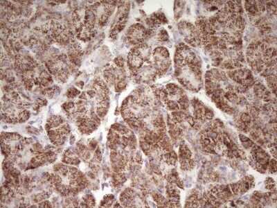 Immunohistochemistry: LRRC6 Antibody (OTI7E9) [NBP2-45674]