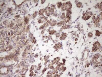 Immunohistochemistry: LRRC6 Antibody (OTI7E9) [NBP2-45674]
