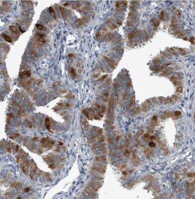 Immunohistochemistry-Paraffin: LRRC6 Antibody [NBP1-82816]
