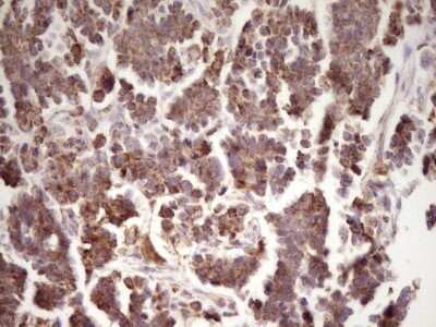 Immunohistochemistry: LRRC6 Antibody (OTI7E9) - Azide and BSA Free [NBP2-72542]