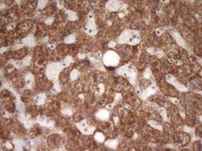Immunohistochemistry: LRRC6 Antibody (OTI7E9) - Azide and BSA Free [NBP2-72542]