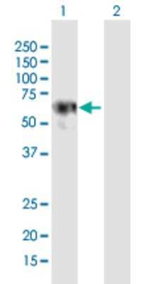 Western Blot: LRRC6 Antibody [H00023639-B01P]