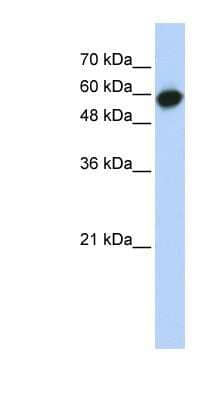 Western Blot: LRRC6 Antibody [NBP1-53157]