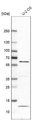 Western Blot: LRRC6 Antibody [NBP1-82816]